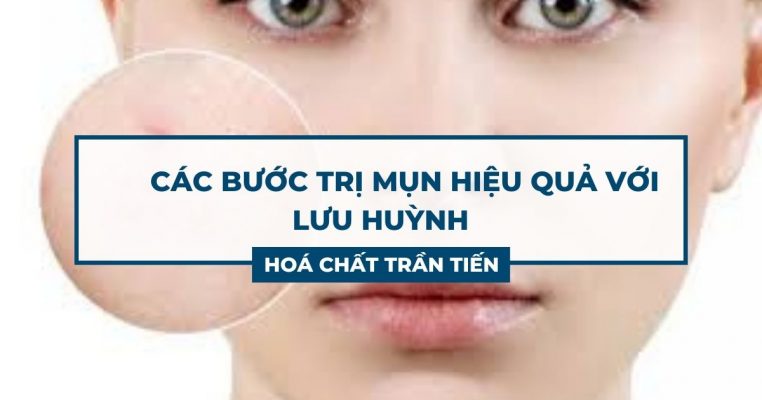 Lưu Huỳnh Trị Mụn