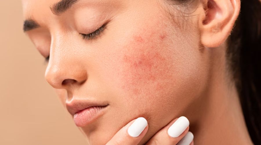 Polyethylene Glycol trong mỹ phẩm