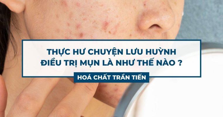 Lưu Huỳnh Trị Mụn
