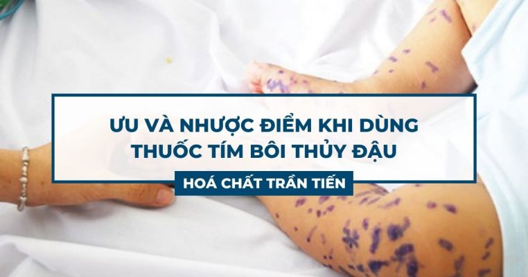 Thuốc Tím Bôi Thủy Đậu